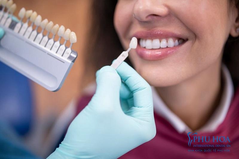 Tại sao cần phải tuân thủ đúng quy trình bọc răng sứ thẩm mỹ đạt chuẩn