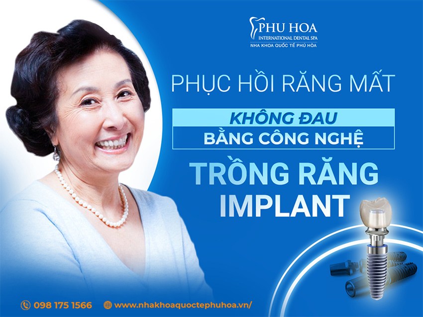 Nha khoa Quốc tế Phú Hòa – Địa chỉ trồng răng Implant uy tín số 1 Hà Nội