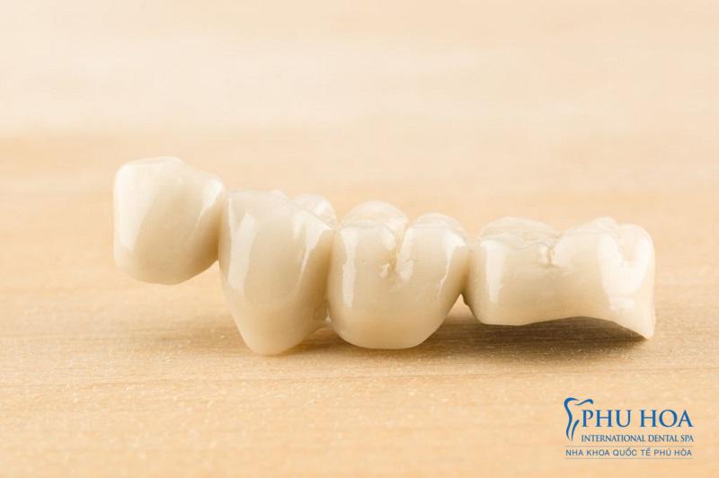 Răng sứ toàn sứ là một trong những loại răng sứ cao cấp với tính thẩm mỹ cao