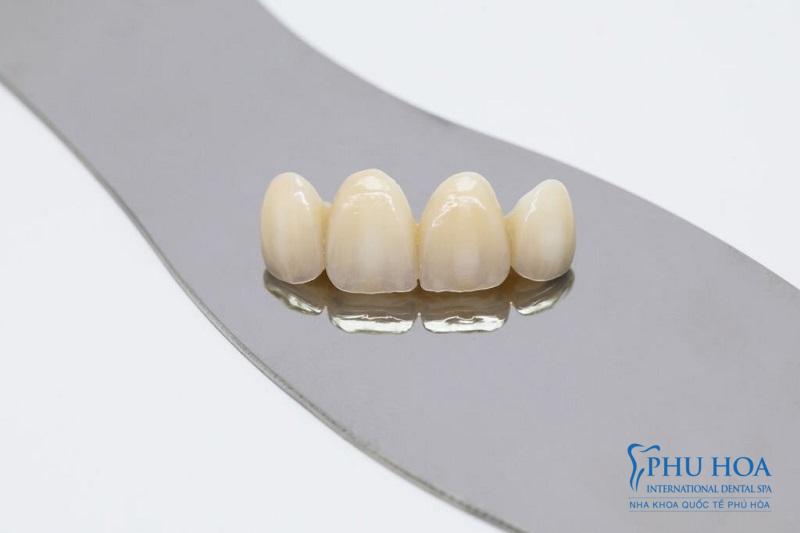 Răng sứ Zirconia với độ cứng vượt trội và tính thẩm mỹ tương đương răng thậtRăng sứ Zirconia