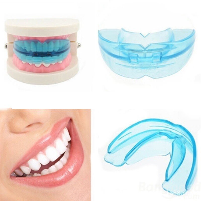 hàm nhựa chỉnh răng