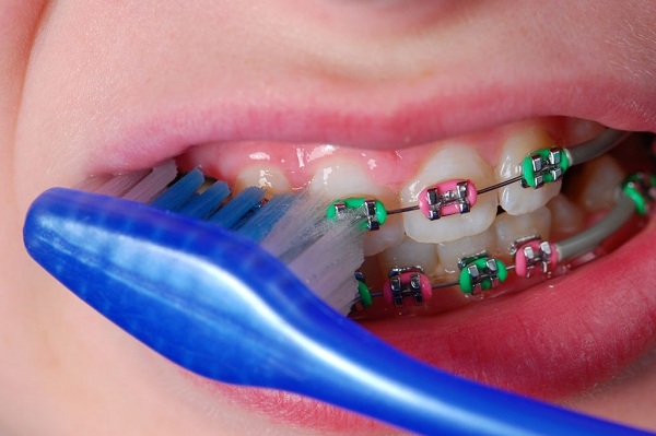 Thói quen vệ sinh răng miệng 1