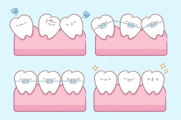 2.1. Cải thiện tình trạng sai lệch của răng miệng 1