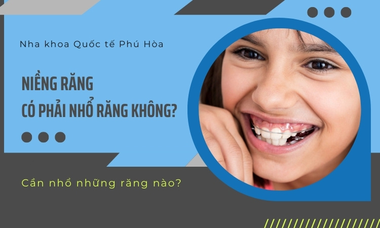 Chuyên gia giải đáp: Niềng răng có phải nhổ răng không? 1