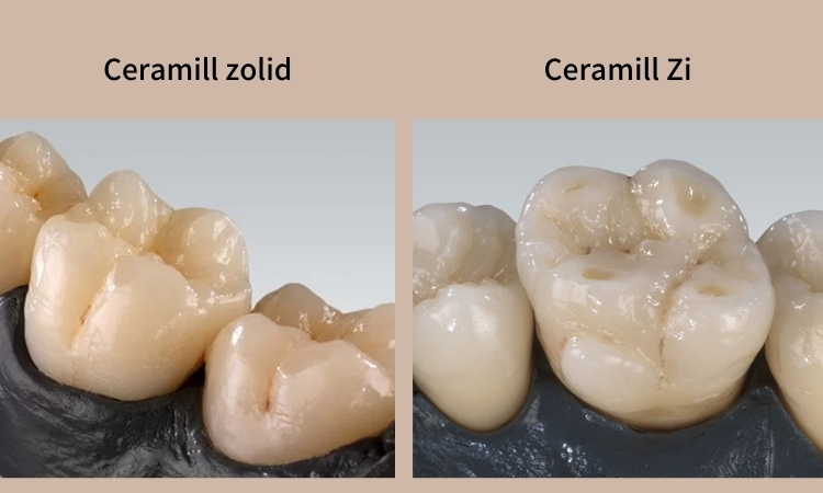 2. Có mấy loại răng sứ Ceramill? 1