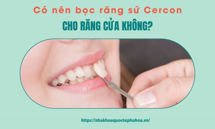 [Giải đáp] Có nên bọc răng sứ Cercon cho răng cửa không? 1