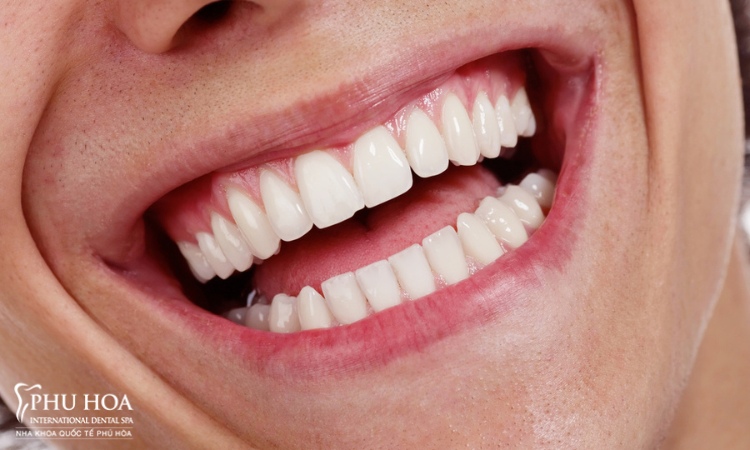 2.2. Vùng răng trong hàm dưới 1