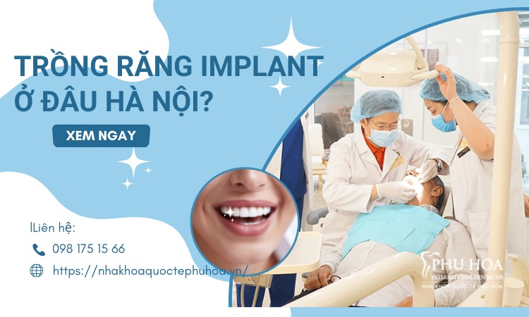 Trồng răng implant ở đâu tốt nhất Hà Nội?