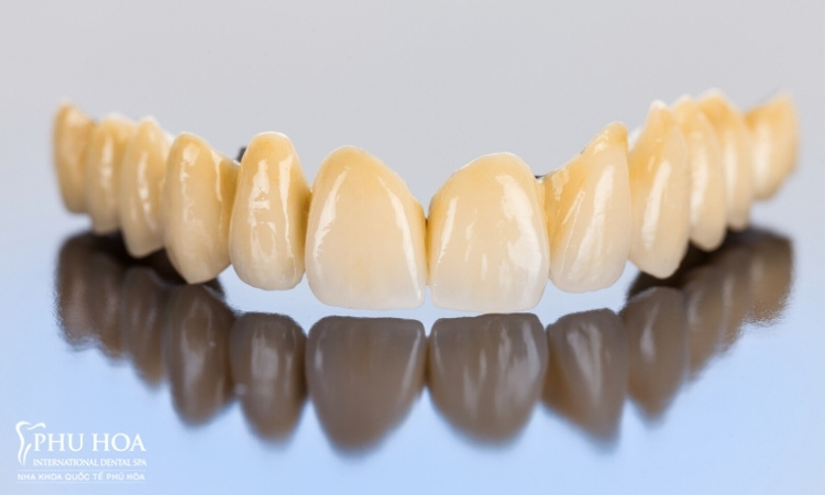 3.1. Răng sứ Ceramco-3 (Mỹ) 1