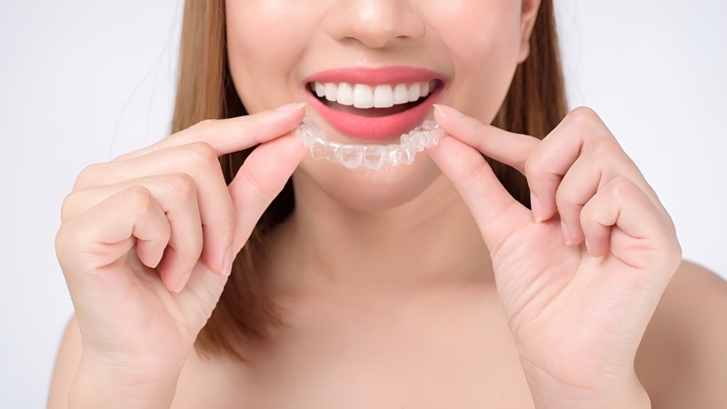 Niềng răng zenyum và invisalign, phương pháp nào hiệu quả hơn