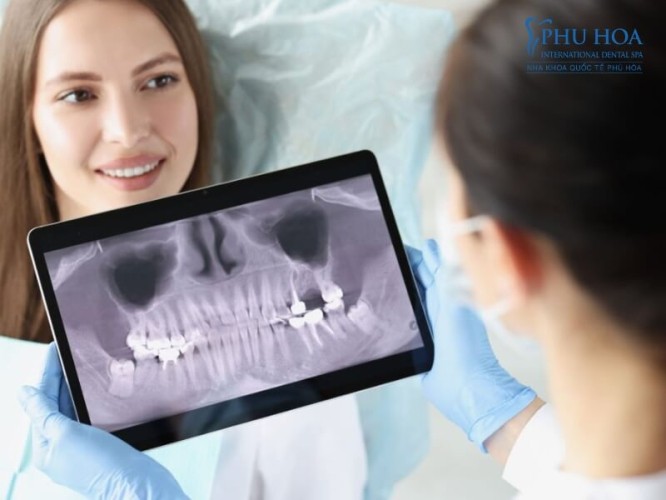 Bác sĩ chụp CT và kiểm tra và tư vấn tình trạng răng