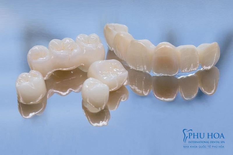 Răng sứ Emax Press bền chắc và tinh tế như răng thật