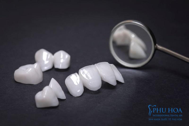 Răng sứ Zirconia là 1 trong các loại răng sứ thẩm mỹ được ưa thích nhất