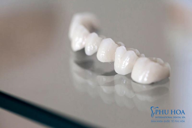 Răng toàn sứ Orodent được coi là loại răng sứ an toàn nhất 