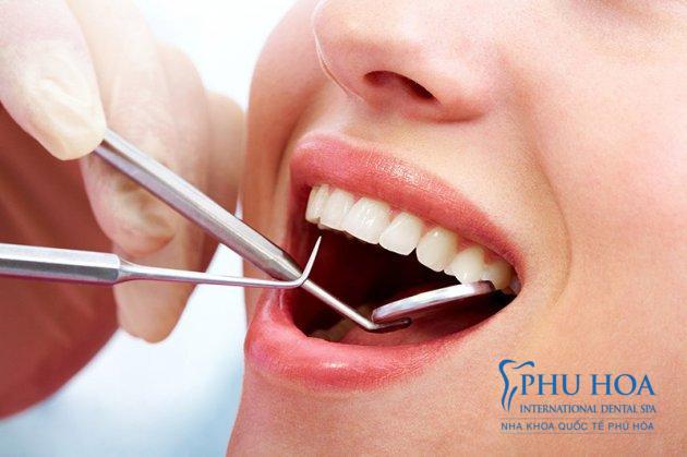 Nhổ răng mà không trồng lại gây ảnh hưởng đến xoang hàm khi mất răng hàm trên
