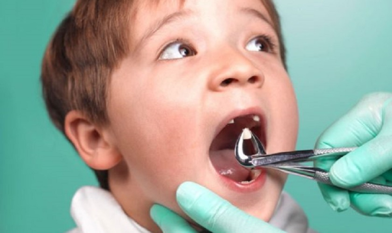 Nên đưa trẻ đến các địa chỉ nha khoa uy tín để nhổ răng sữa