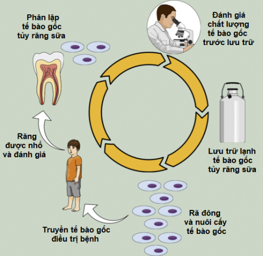 Quy trình lưu trữ tế bào gốc từ răng sữa