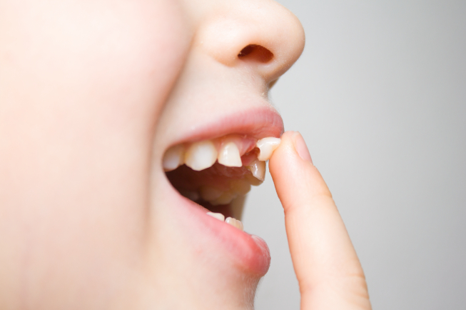 Các trường hợp trẻ được chỉ định và chống chỉ định nhổ răng sữa